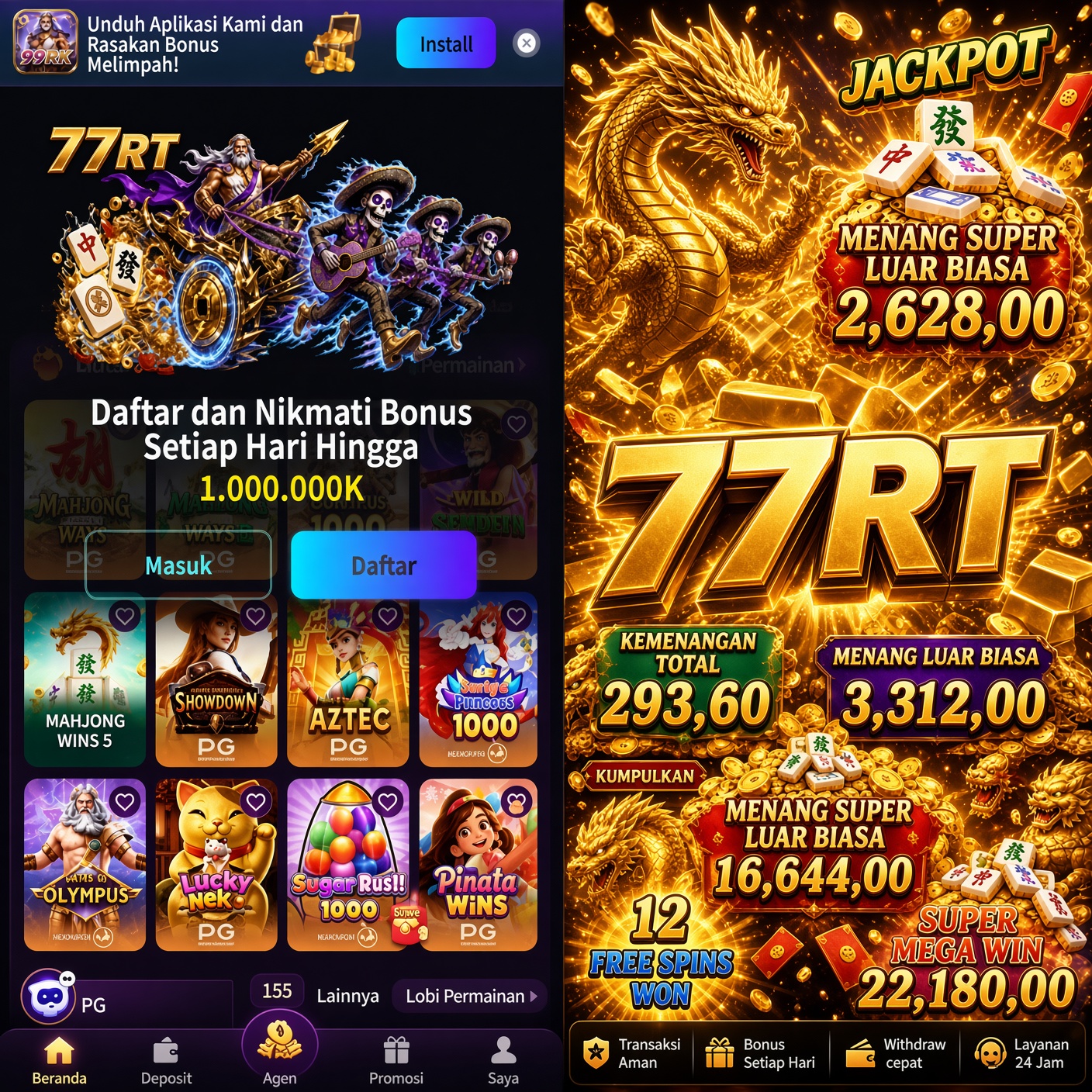 77RT